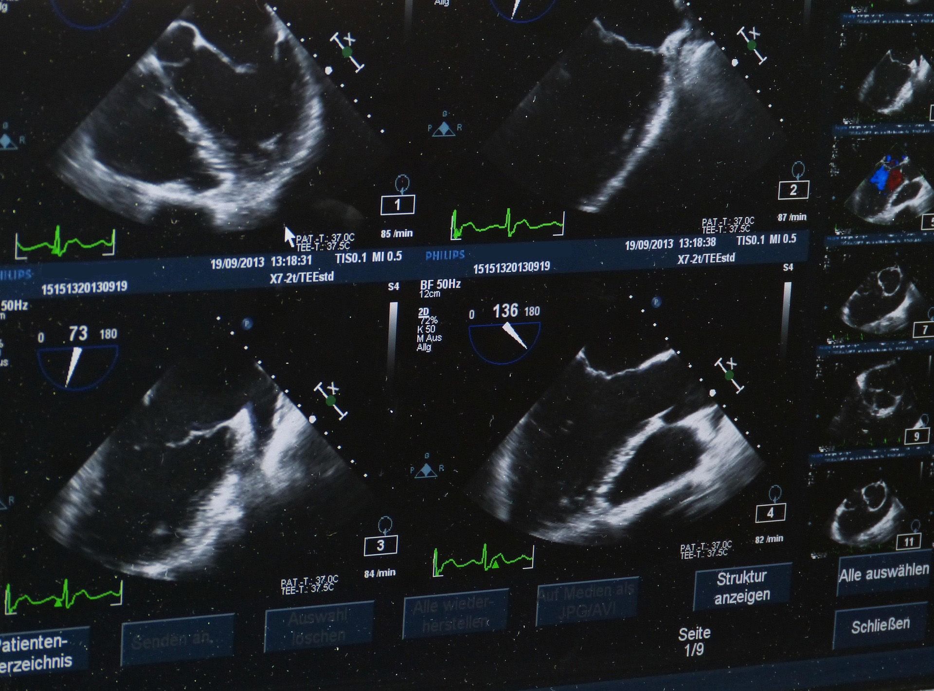 Abdominal ultrasound